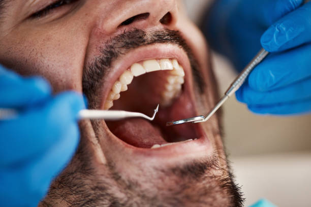 Best Cracked Tooth Emergency Dentist  in West Carthage, NY